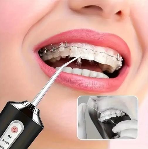 Irrigador Bucal Portátil Recargable – Limpieza Profesional en Casa