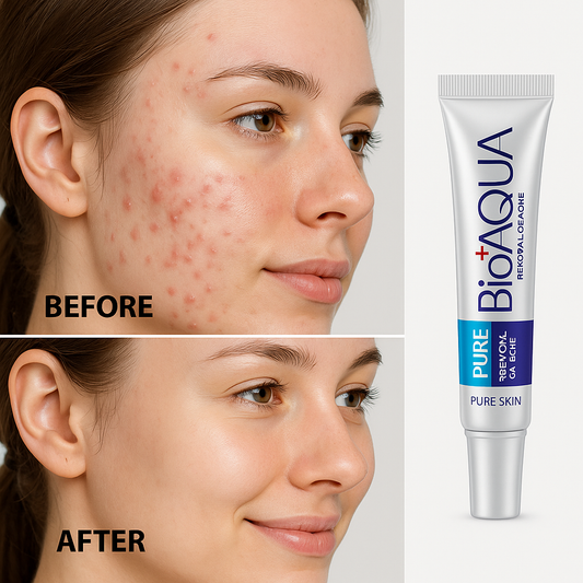 CREMA ANTIACNE BIOAQUA-PREMIUM